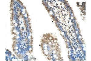 ALDH4A1 antibody was used for immunohistochemistry at a concentration of 4-8 ug/ml to stain Epithelial cells of intestinal villus (arrows) in Human Intestine. (ALDH4A1 抗体  (N-Term))