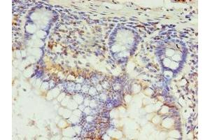 Immunohistochemistry of paraffin-embedded human small intestine tissue using ABIN7164533 at dilution of 1:100