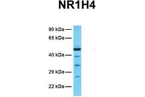 Host:  Rabbit  Target Name:  NR1H4  Sample Tissue:  Human 786-0  Antibody Dilution:  1.