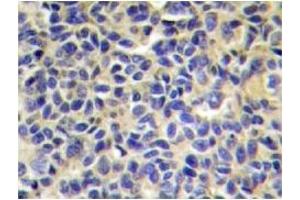 Image no. 1 for anti-Endoplasmic Reticulum Aminopeptidase 1 (ERAP1) antibody (ABIN272255) (ERAP1 抗体)