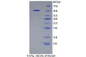SDS-PAGE analysis of Rat Ribonuclease A Protein. (RNASE1 蛋白)