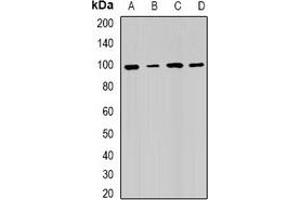 Western blot analysis of RRM1 expression in Hela (A), SW480 (B), mouse testis (C), mouse spleen (D) whole cell lysates. (RRM1 抗体)