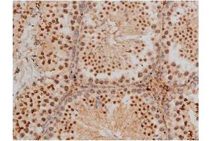 Immunohistochemistry (IHC) image for anti-cAMP Responsive Element Binding Protein 1 (CREB1) (pSer133) antibody (ABIN6256130)