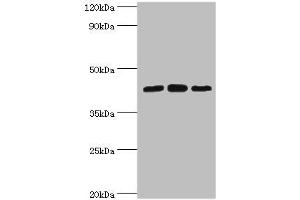 Western blot All lanes: Nucleolysin TIA-1 isoform p40 antibody at 2 μg/mL Lane 1: Jurkat whole cell lysate Lane 2: K562 whole cell lysate Lane 3: Hela whole cell lysate Secondary Goat polyclonal to rabbit IgG at 1/10000 dilution Predicted band size: 43, 42, 25 kDa Observed band size: 43 kDa (TIA1 抗体  (AA 1-193))