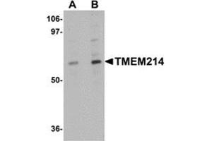 Western blot analysis of TMEM214 in A20 cell lysate with this product at (A) 1 and (B) 2 μg/ml. (TMEM214 抗体  (N-Term))