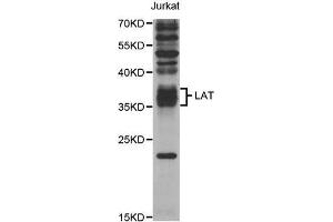 Western Blotting (WB) image for anti-Linker For Activation of T Cells (LAT) antibody (ABIN1876851) (LAT 抗体)