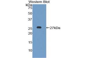 Detection of Recombinant LILRB3, Mouse using Polyclonal Antibody to Leukocyte Immunoglobulin Like Receptor Subfamily B, Member 3 (LILRB3) (LILRB3 抗体  (AA 410-631))