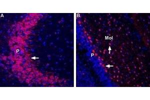 Immunohistochemistry (IHC) image for anti-Glutamate Receptor, Ionotropic, Kainate 3 (GRIK3) (AA 46-58), (Extracellular) antibody (ABIN7043239)