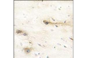 Formalin-fixed and paraffin-embedded human brain tissue reacted with MARK1 Antibody (N-term), which was peroxidase-conjugated to the secondary antibody, followed by DAB staining. (MARK1 抗体  (N-Term))