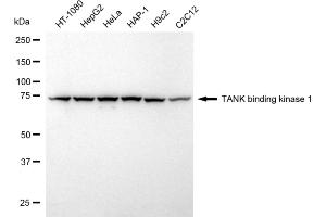 Western blotting analysis using TANK binding kinase 1 antibody (ABIN7800507). (Recombinant TBK1 抗体)