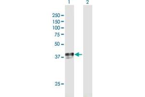 Western Blot analysis of SLC29A1 expression in transfected 293T cell line by SLC29A1 MaxPab polyclonal antibody. (SLC29A1 抗体  (AA 1-456))