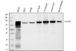Western blot analysis of GLDC using anti-GLDC antibody (ABIN7602072).