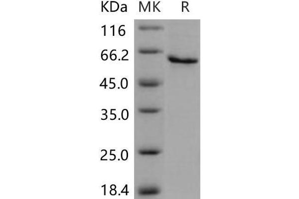 SERPINB12 Protein (His tag)