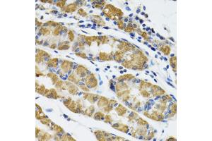Immunohistochemistry of paraffin-embedded human stomach using HAPLN1 antibody (ABIN5973979) at dilution of 1/100 (40x lens). (HAPLN1 抗体)