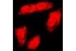 Immunofluorescent analysis of BRCA1 (pS1423) staining in HeLa cells. (BRCA1 抗体  (C-Term, pSer1423))
