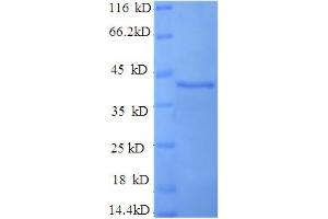 SDS-PAGE (SDS) image for Synaptotagmin I (SYT1) (AA 99-416), (Cytoplasmic Domain), (Cytosolic) protein (His tag) (ABIN5710450)