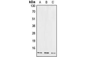 Western blot analysis of Cystatin B expression in JAR (A), EOC20 (B), U87MG (C) whole cell lysates. (CSTB 抗体  (Center))
