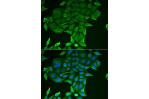 Immunofluorescence analysis of HeLa cells using CD84 antibody (ABIN6132251, ABIN6138235, ABIN6138236 and ABIN6222077). (CD84 抗体  (AA 22-225))