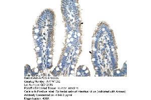 Rabbit Anti-APCS Antibody  Paraffin Embedded Tissue: Human Intestine Cellular Data: Epithelial cells of intestinal villas Antibody Concentration: 4. (APCS 抗体  (N-Term))
