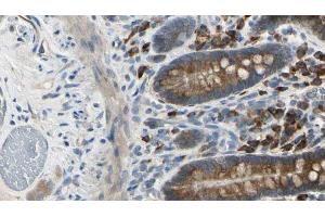 ABIN6274155 at 1/100 staining Mouse intestine tissue by IHC-P. (ADRA2A 抗体  (Internal Region))