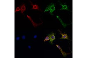 ABIN6260516 and ABIN6267035 staining HepG2 by IF/ICC.