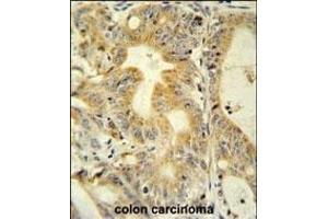 Immunohistochemistry (Paraffin-embedded Sections) (IHC (p)) image for anti-Tumor Necrosis Factor Receptor Superfamily, Member 6b, Decoy (TNFRSF6B) (AA 22-48), (N-Term) antibody (ABIN654095)