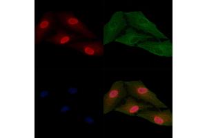 ABIN6257633 and ABIN6274769 staining  cells by IF/ICC. (RPL15 抗体  (C-Term))