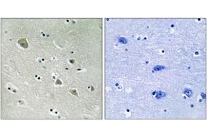 Immunohistochemistry analysis of paraffin-embedded human brain, using PAK1 (Phospho-Ser204) Antibody. (PAK1 抗体  (pSer204))