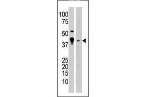 The MBD2 polyclonal antibody  is used in Western blot to detect MBD2 in A-375 cell lysate (lane 1) and mouse brain tissue lysate (lane 2) lysate. (MBD2 抗体  (N-Term))