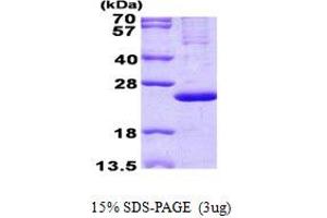 MRPL13 Protein (His tag)