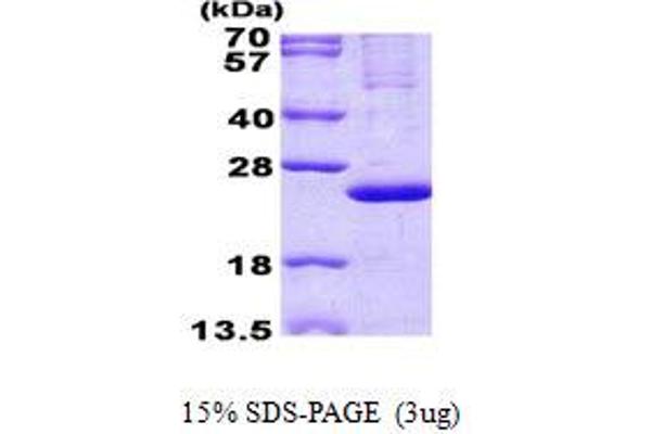MRPL13 Protein (His tag)