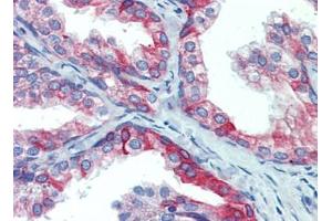 Prostate, Human: Formalin-Fixed, Paraffin-Embedded (FFPE) (PDIA4 抗体  (AA 623-638))