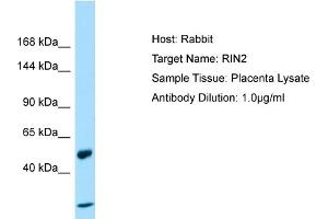 Host: Rabbit Target Name: RIN2 Sample Type: Placenta lysates Antibody Dilution: 1. (RIN2 抗体  (N-Term))