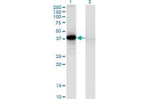 Western Blot analysis of SORD expression in transfected 293T cell line by SORD monoclonal antibody (M03), clone 1C2. (SORD 抗体  (AA 1-357))