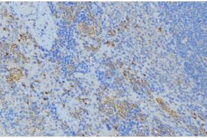 ABIN6277012 at 1/100 staining Human lymph node tissue by IHC-P. (CDA 抗体  (Internal Region))