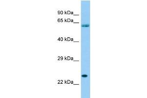 Host: Rabbit Target Name: SPCS3 Sample Type: THP-1 Whole Cell lysates Antibody Dilution: 1. (SPCS3 抗体  (Middle Region))