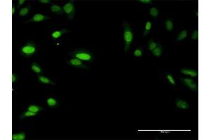 Immunofluorescence of purified MaxPab antibody to SIRT7 on HeLa cell. (SIRT7 抗体  (AA 1-400))