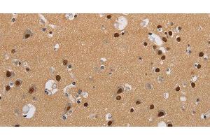 Immunohistochemistry of paraffin-embedded Human brain using KCNG4 Polyclonal Antibody at dilution of 1:40