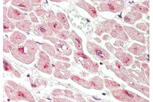 Immunohistochemistry (IHC) image for anti-Dihydrolipoamide S-Succinyltransferase (E2 Component of 2-Oxo-Glutarate Complex) (DLST) (C-Term) antibody (ABIN2788818)