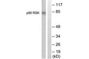 Western blot analysis of extracts from 293 cells, treated with PMA 125ng/ml 30', using p90 RSK (Ab-359/363) Antibody. (RPS6KA3 抗体  (AA 331-380))