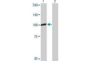 Western Blot analysis of CTNNB1 expression in transfected 293T cell line by CTNNB1 monoclonal antibody (M02), clone 1C9. (CTNNB1 抗体  (AA 682-781))