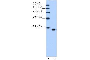 WB Suggested Anti-PEBP1 Antibody Titration:  1. (PEBP1 抗体  (C-Term))