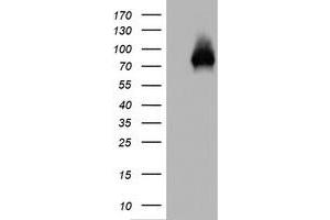 Western Blotting (WB) image for anti-Tumor Protein P63 (TP63) antibody (ABIN2673817) (p63 抗体)