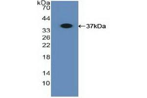 Detection of Recombinant MHCB, Human using Polyclonal Antibody to Major Histocompatibility Complex Class I B (MHCB) (HLA-B 抗体  (AA 26-309))