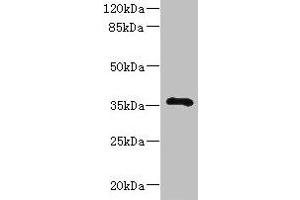 Western blot All lanes: GIMAP7 antibody at 2 μg/mL + Jurkat whole cell lysate Secondary Goat polyclonal to rabbit IgG at 1/10000 dilution Predicted band size: 35 kDa Observed band size: 35 kDa (GIMAP7 抗体  (AA 1-273))