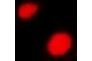Immunofluorescent analysis of LHX6 staining in A549 cells. (LHX6 抗体)