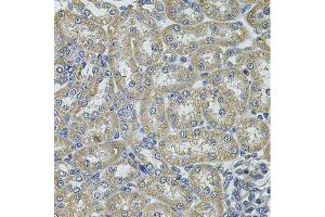 Immunohistochemistry (Paraffin-embedded Sections) (IHC (p)) image for anti-DnaJ (Hsp40) Homolog, Subfamily A, Member 3 (DNAJA3) (AA 221-480) antibody (ABIN6139698)