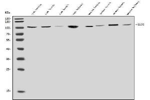 Western blot analysis of ClC-5/CLCN5 using anti-ClC-5/CLCN5 antibody (ABIN7599619).
