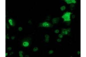 Immunofluorescence (IF) image for anti-Tumor Protein P53 (TP53) antibody (ABIN1499977) (p53 抗体)