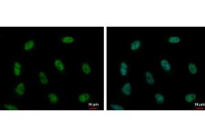 Immunofluorescence (IF) image for anti-Poly-U Binding Splicing Factor 60KDa (PUF60) antibody (ABIN2855270)